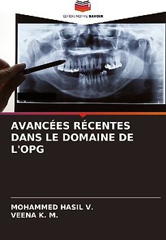 AVANCÉES RÉCENTES DANS LE DOMAINE DE L'OPG