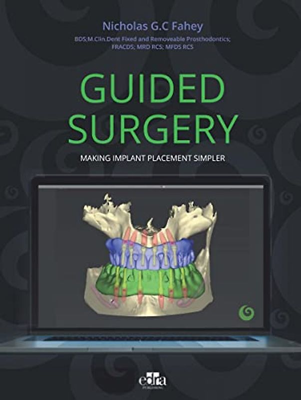 Guided Surgery - Making Implant Placement Simpler
