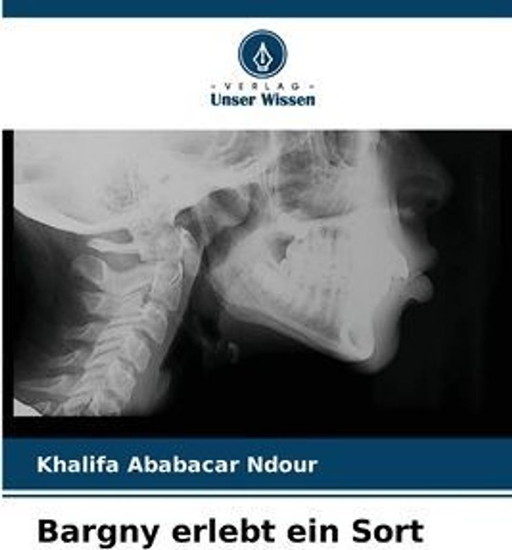 Bargny erlebt ein Sort