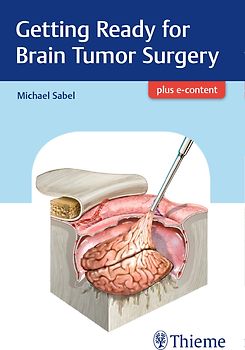 Getting Ready for Brain Tumor Surgery