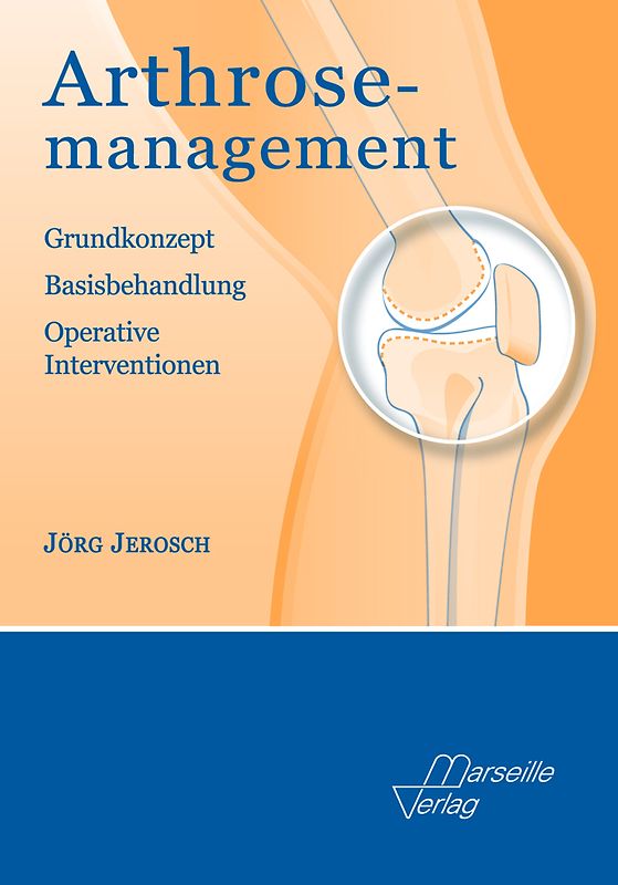 Arthrose-Management
