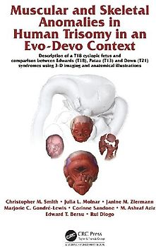 Muscular and Skeletal Anomalies in Human Trisomy in an Evo-Devo Context