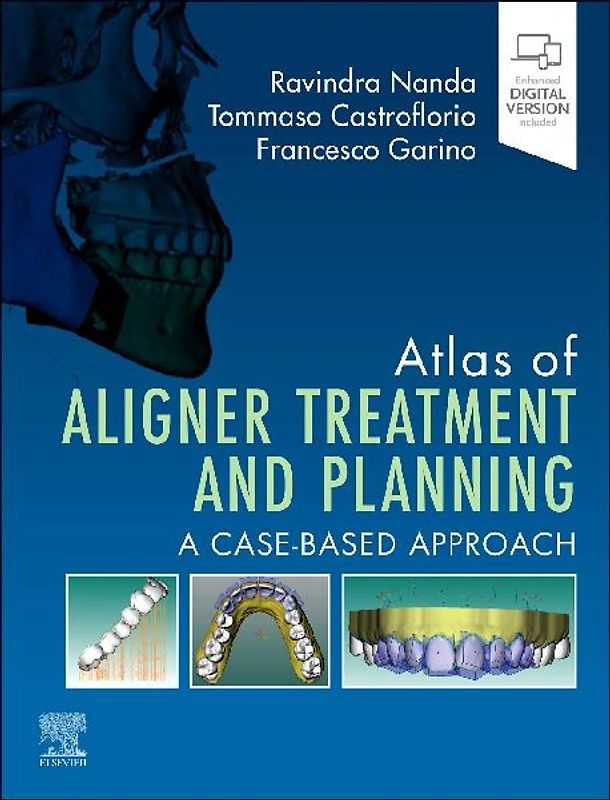 Atlas of Aligner Treatment and Planning
