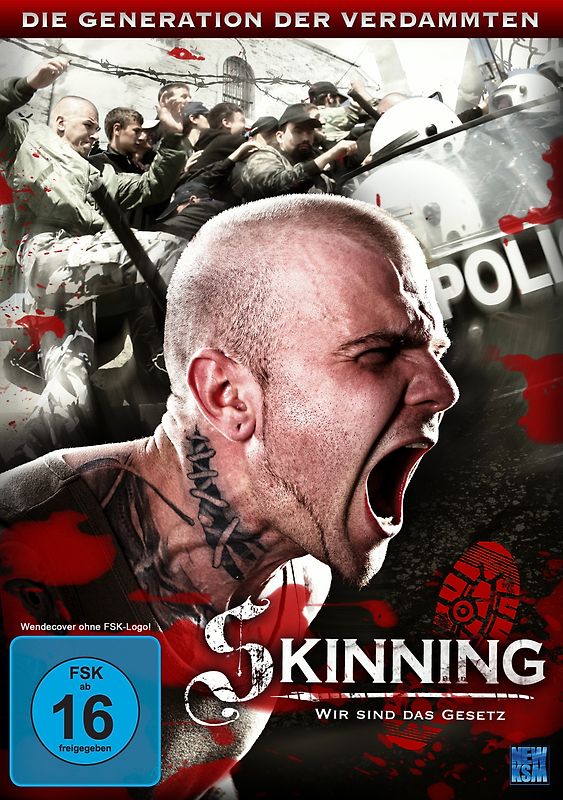 Skinning - Wir sind das Gesetz DVD