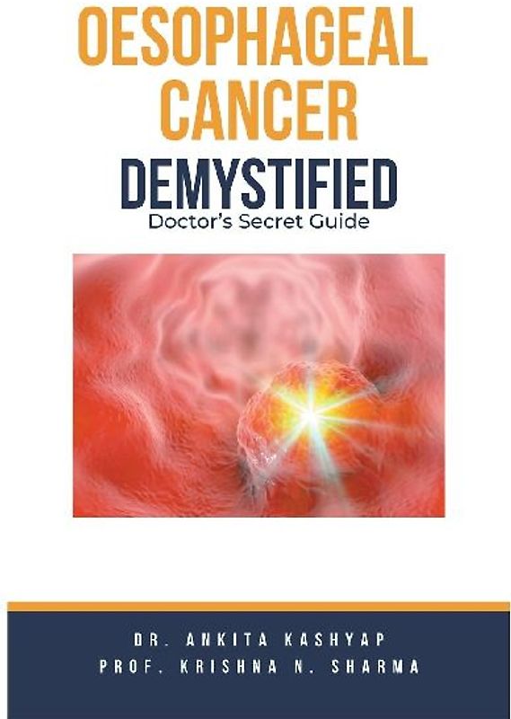 Oesophageal Cancer Demystified Doctors Secret Guide