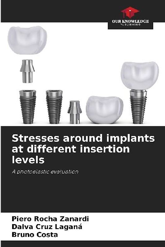 Stresses around implants at different insertion levels