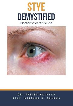 Stye Demystified