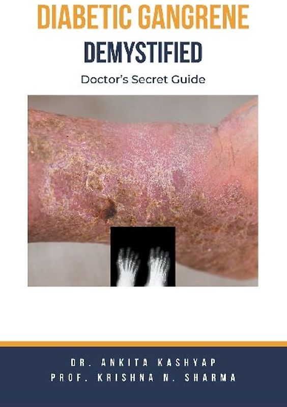 Diabetic Gangrene Demystified