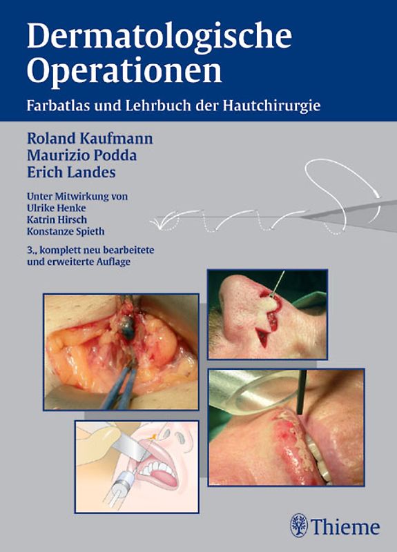 Dermatologische Operationen