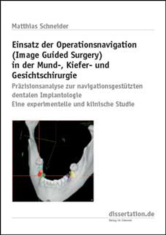Einsatz der Operationsnavigation (Image Guided Surgery) in der Mund-, Kiefer- und Gesichtschirurgie