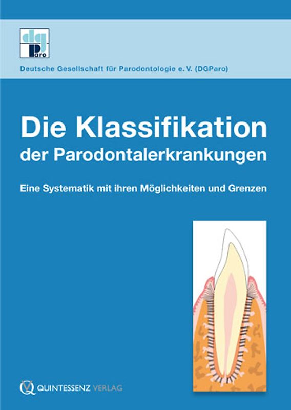 Die Klassifikation der Parodontalerkrankungen