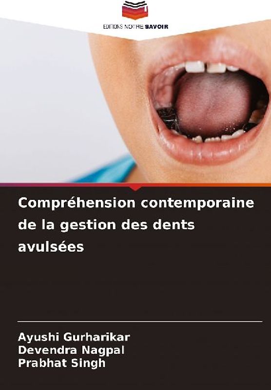 Compréhension contemporaine de la gestion des dents avulsées