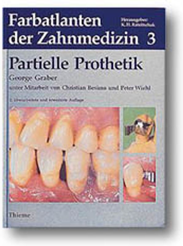 Partielle Prothetik