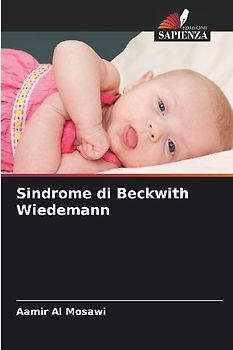 Sindrome di Beckwith Wiedemann