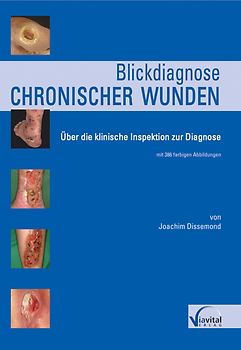 Blickdiagnose chronischer Wunden