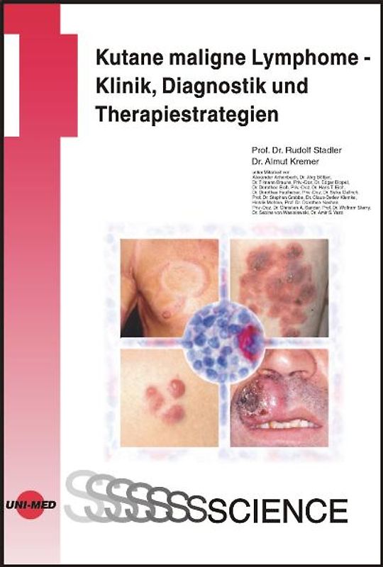Kutane maligne Lymphome - Klinik, Diagnostik und Therapiestrategien