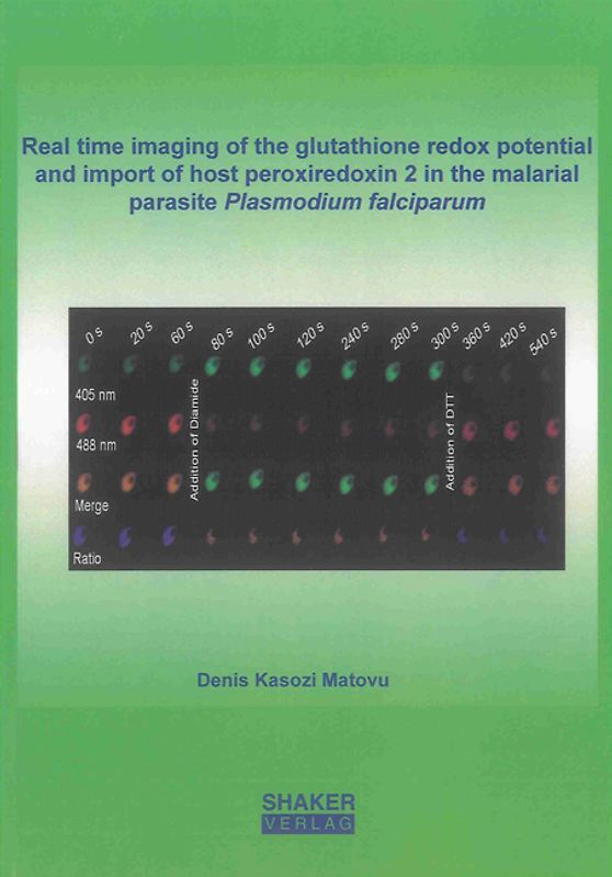 Real time imaging of the glutathione redox potential and import of host peroxiredoxin 2 in the malarial parasite Plasmodium falciparum