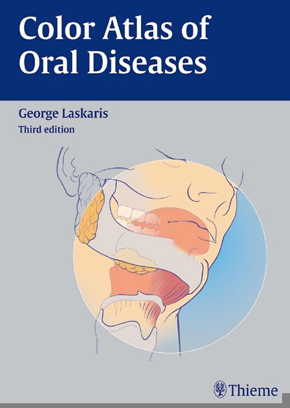 Color Atlas of Oral Diseases