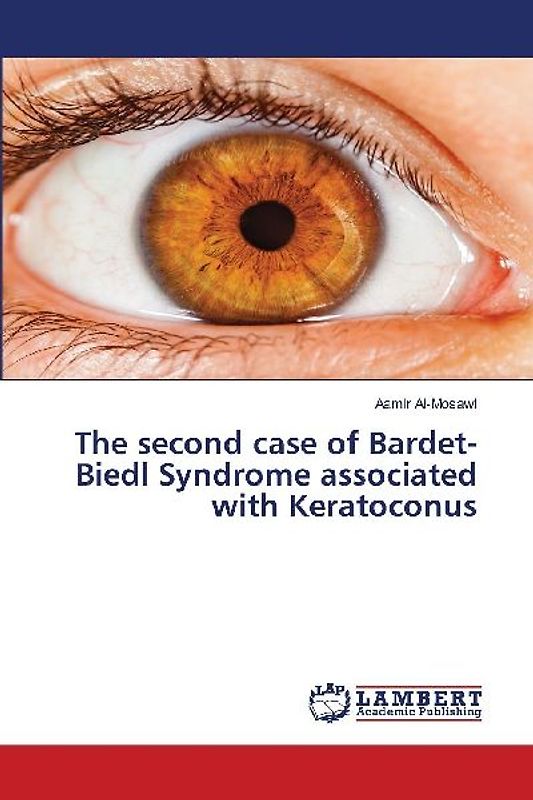 The second case of Bardet-Biedl Syndrome associated with Keratoconus