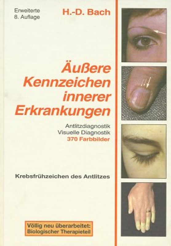 Antlitzdiagnostik / Äussere Kennzeichen innerer Erkrankungen
