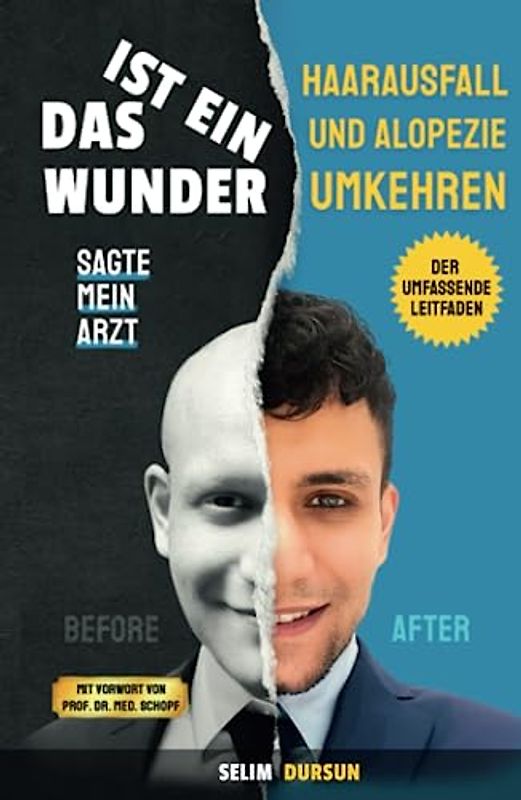 DAS IST EIN WUNDER SAGTE MEIN ARZT: HAARVERLUST UND ALOPEZIE UMKEHREN