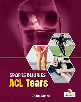 ACL Tears