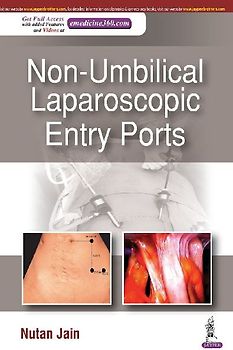 Non-Umbilical Laparoscopic Entry Ports