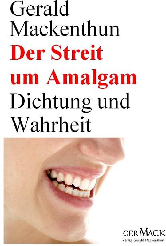 Der Streit um Amalgam