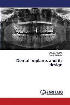 Dental Implants and its design
