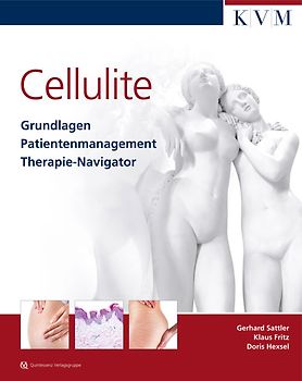 Cellulite