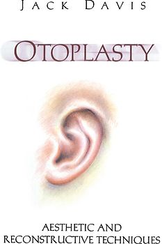 Otoplasty