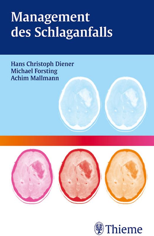 Management des Schlaganfalls