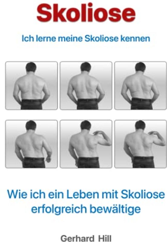 Skoliose: Ich lerne meine Skoliose kennen