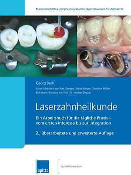Laserzahnheilkunde