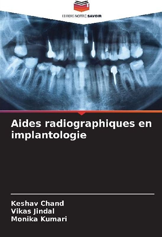 Aides radiographiques en implantologie