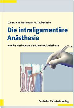 Die intraligamentäre Anästhesie