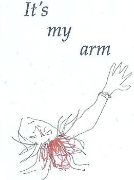 It's my arm