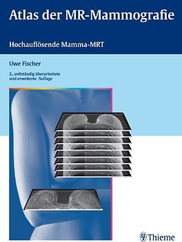 Atlas der MR-Mammografie