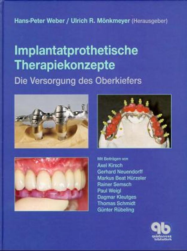 Implantatprothetische Therapiekonzepte
