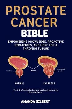 Prostate Cancer Bible: Empowering Knowledge, Proactive Strategies, and Hope for a Thriving Future