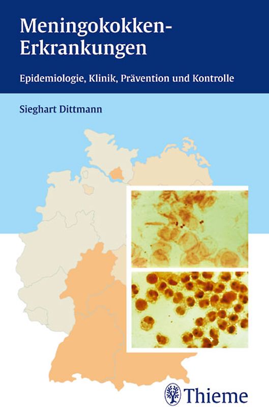 Meningokokken-Erkrankungen