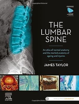 The Lumbar Spine: An Atlas of Normal Anatomy and the Morbid Anatomy of Ageing and Injury