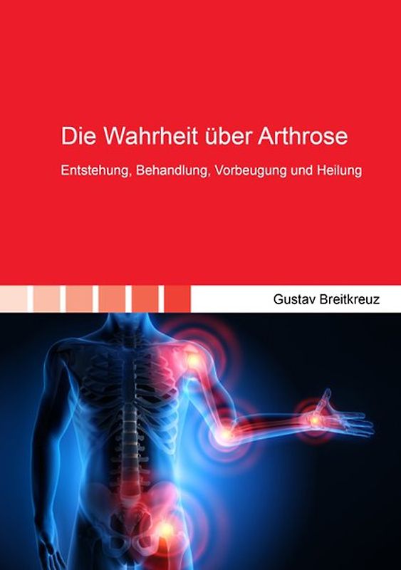 Die Wahrheit über Arthrose