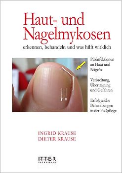 Haut- und Nagelmykosen