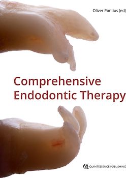 Comprehensive Endodontic Therapy