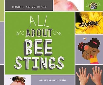All about Bee Stings