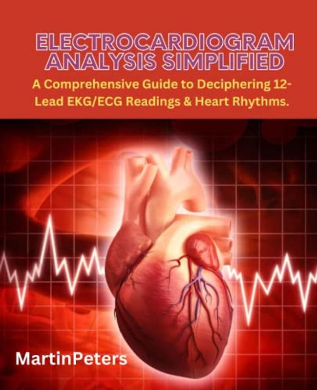 Electrocardiogram Analysis Simplified: A Comprehensive Guide to Deciphering 12-Lead EKG/ECG Readings & Heart Rhythms.