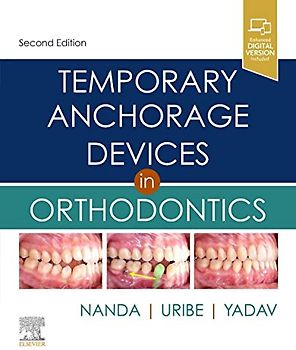 Temporary Anchorage Devices in Orthodontics