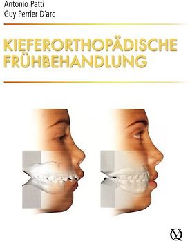 Kieferorthopädische Frühbehandlung