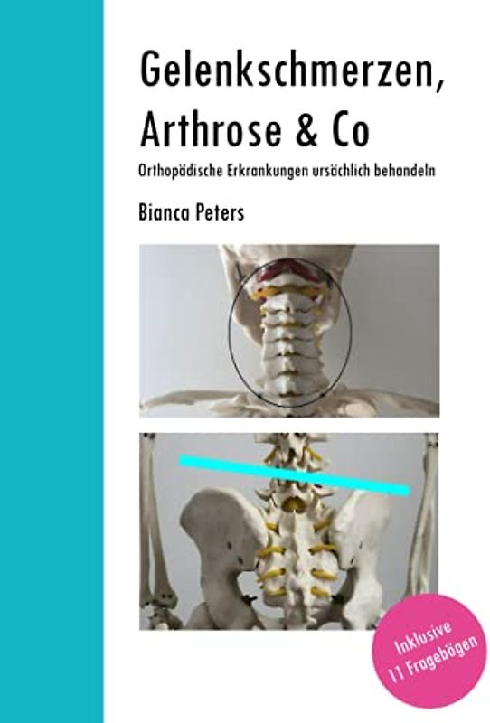 Gelenkschmerzen, Arthrose & Co: Orthopädische Erkrankungen ursächlich behandeln